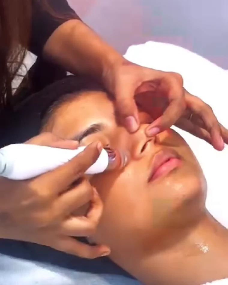 A fine handheld tool worked along the nose and cheek to clear the skin.